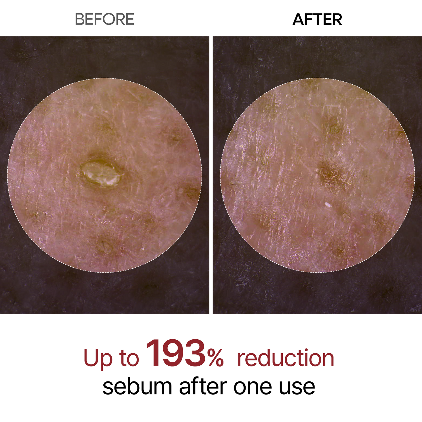 Dr.Melaxin Black Rice Exfoliating Ampoule, Pore & Blackhead Care Serum with AHA BHA