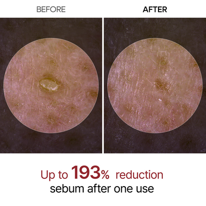 Dr.Melaxin Black Rice Exfoliating Ampoule, Pore & Blackhead Care Serum with AHA BHA